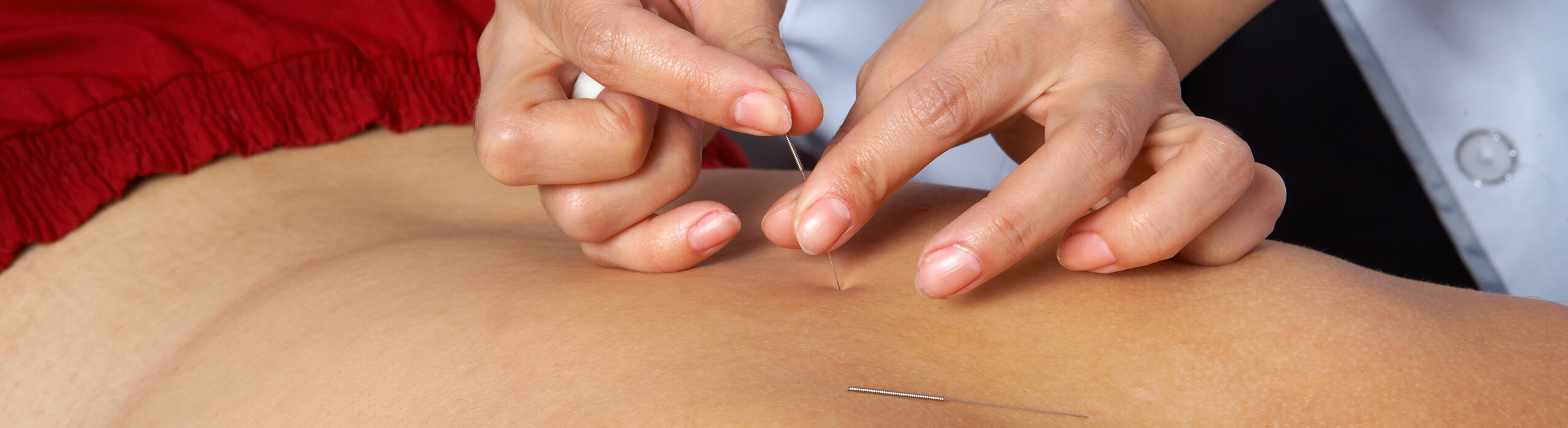 Functional Dry Needling El Paso, Horizon City, TX & Las Cruces, NM